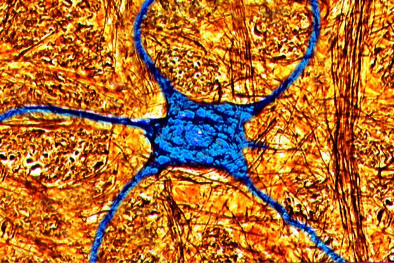 Human Neuron, Digital Light Microscope. (Photo By BSIP/Universal Images Group via Getty Images)